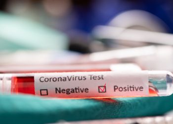 Sector minero argentino contra el covid-19