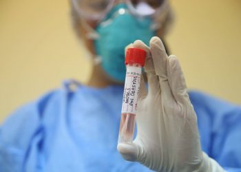 Prueba rápida molecular