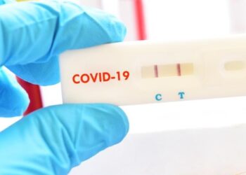 Chile: SQM entrega 7,000 test rápidos en provincia de Tocopilla