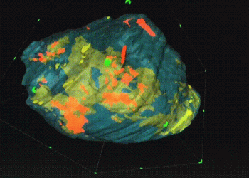 La degradación del material dentro de las baterías de iones de litio finalmente se entiende